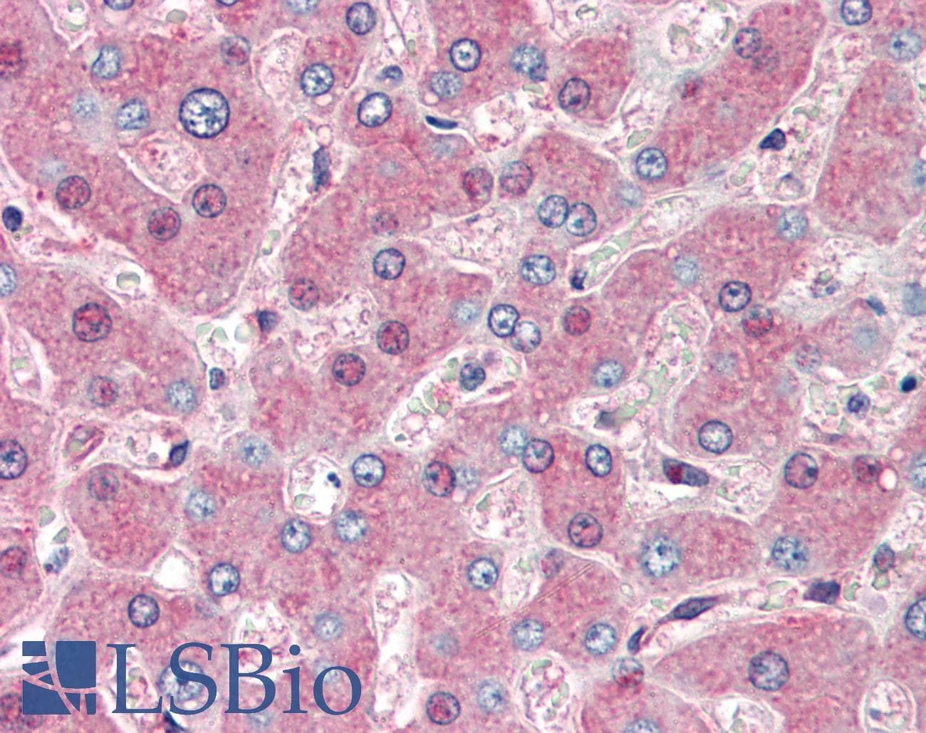 IHC-plus™ Polyclonal Goat anti-Human HSP90B1 / GP96 / GRP94 Antibody (aa593-606, IHC, WB)