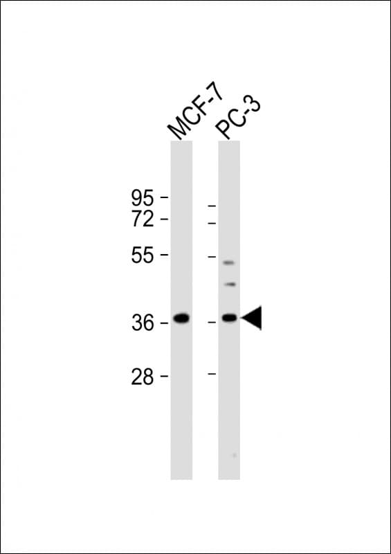 Polyclonal Rabbit anti-Human VEGFA / VEGF Antibody (IHC, WB)