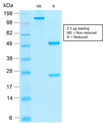 PathPlus™ THBD / CD141 / Thrombomodulin Antibody (aa 69-194, clone rTHBD/1591)