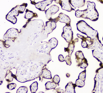 PLAT / TPA Antibody