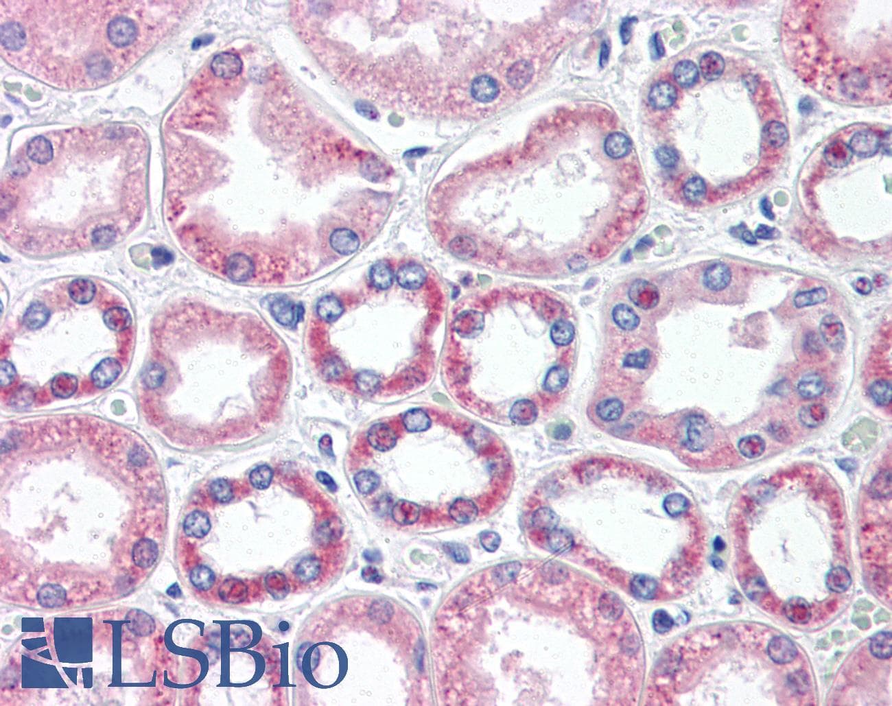 IHC-plus™ ADGRB3 / BAI3 Antibody (aa1506-1522)