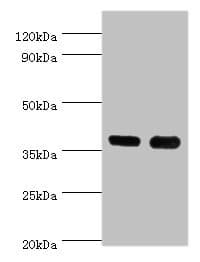 Polyclonal Rabbit anti-Human CD1A Antibody (aa21-181, WB)
