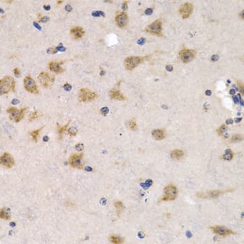 CDC25A Antibody