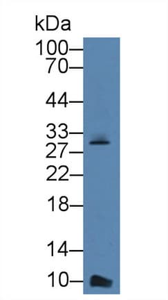 CXCL7 / PPBP Antibody (aa40-113)