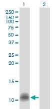Monoclonal Mouse anti-Human CCL14 Antibody (clone 1F12, WB)