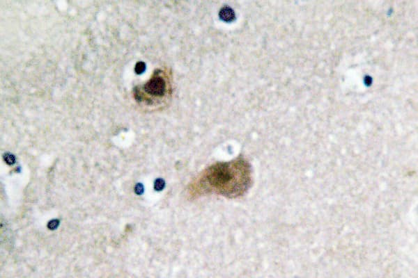 COPS5 / JAB1 Antibody (Lys191)