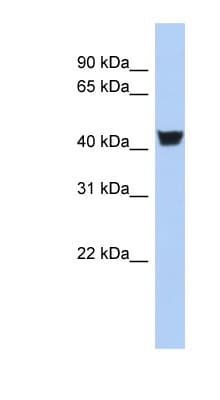 TH / Tyrosine Hydroxylase Antibody (N-Terminus)