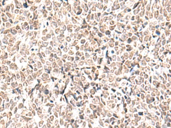 EWSR1 / EWS Antibody