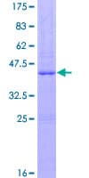 Human PLA2G2A / SPLA2 Protein (Recombinant GST)