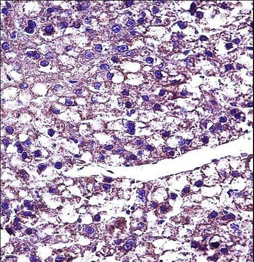 PROC / Protein C Antibody (aa177-206)