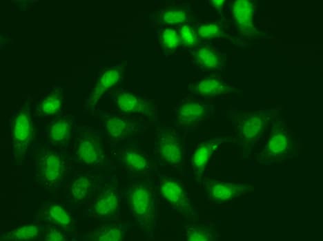 CETN2 / Centrin 2 Antibody