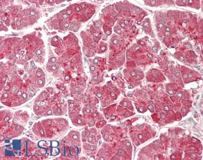 IHC-plus™ OGT / O-GLCNAC Antibody
