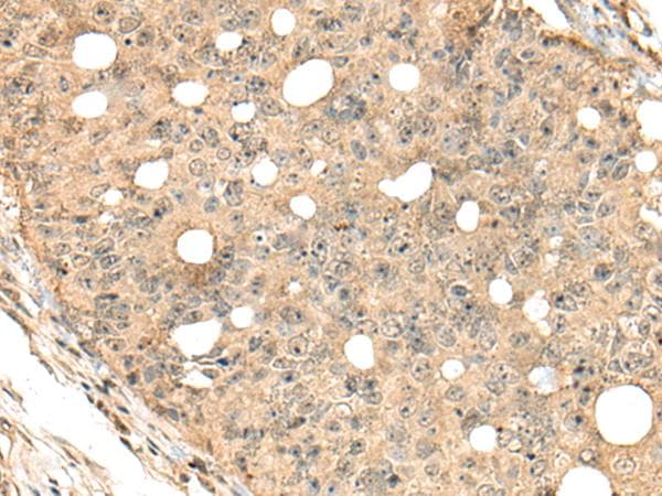 CA7 / Carbonic Anhydrase VII Antibody