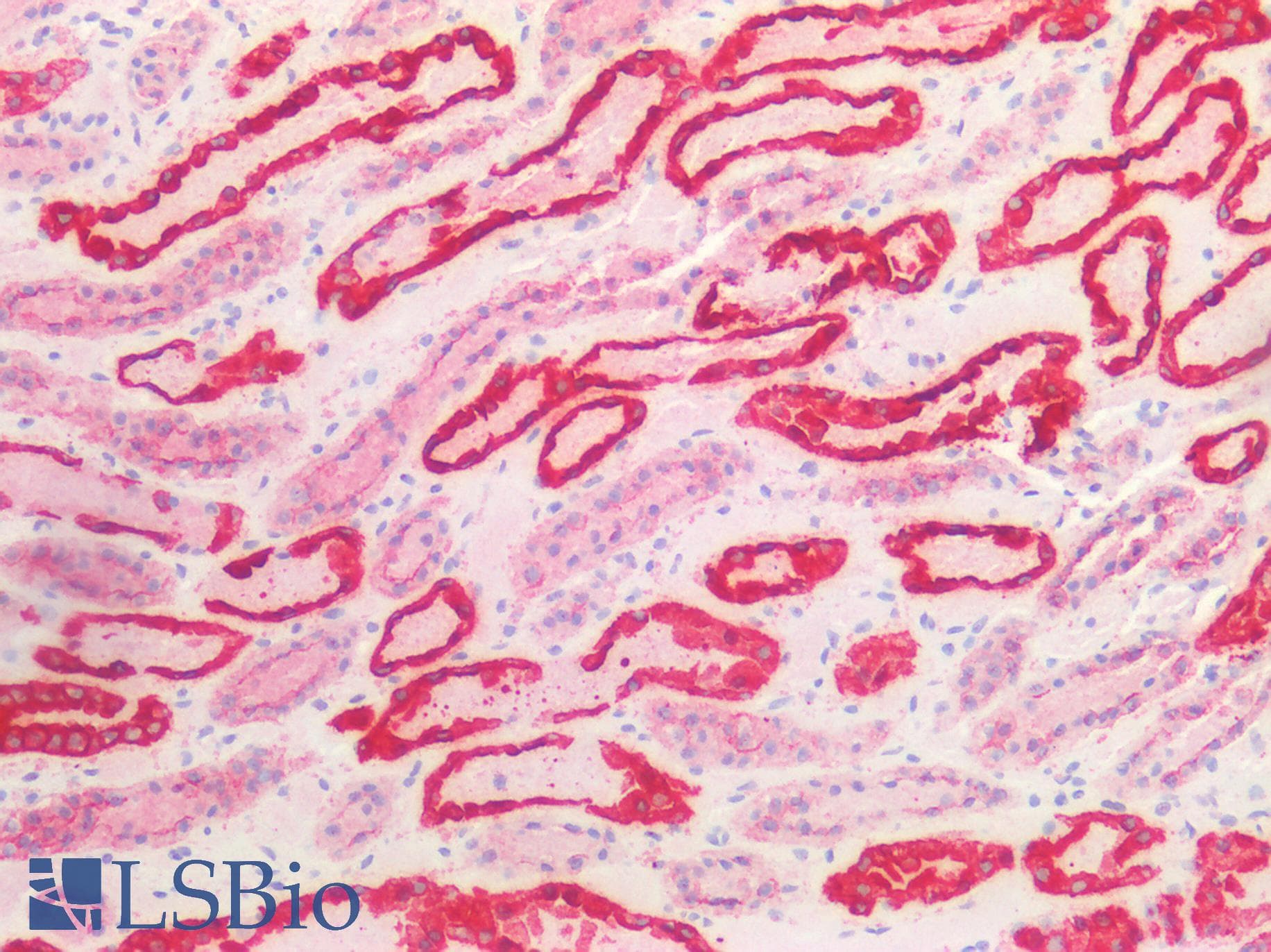 PathPlus™ KRT8 / CK8 / Cytokeratin 8 Antibody