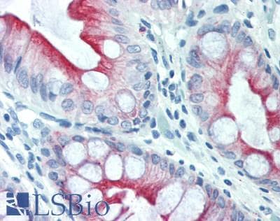 PathPlus™ GREM1 / Gremlin-1 Antibody (aa25-184)
