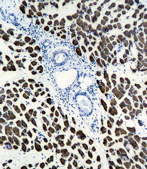 ACTA1 / Skeletal Muscle Actin Antibody