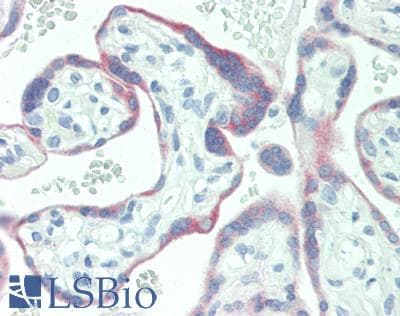 KISS1 / Kisspeptin / Metastin Antibody (aa20-138)