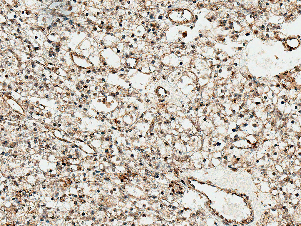 SFRP1 Antibody