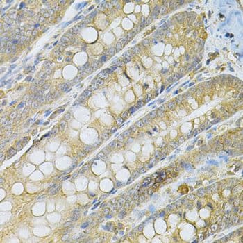 SERPINA6 / CBG Antibody