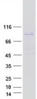 Human TTC39B Protein (Recombinant Myc-DDK (Flag))