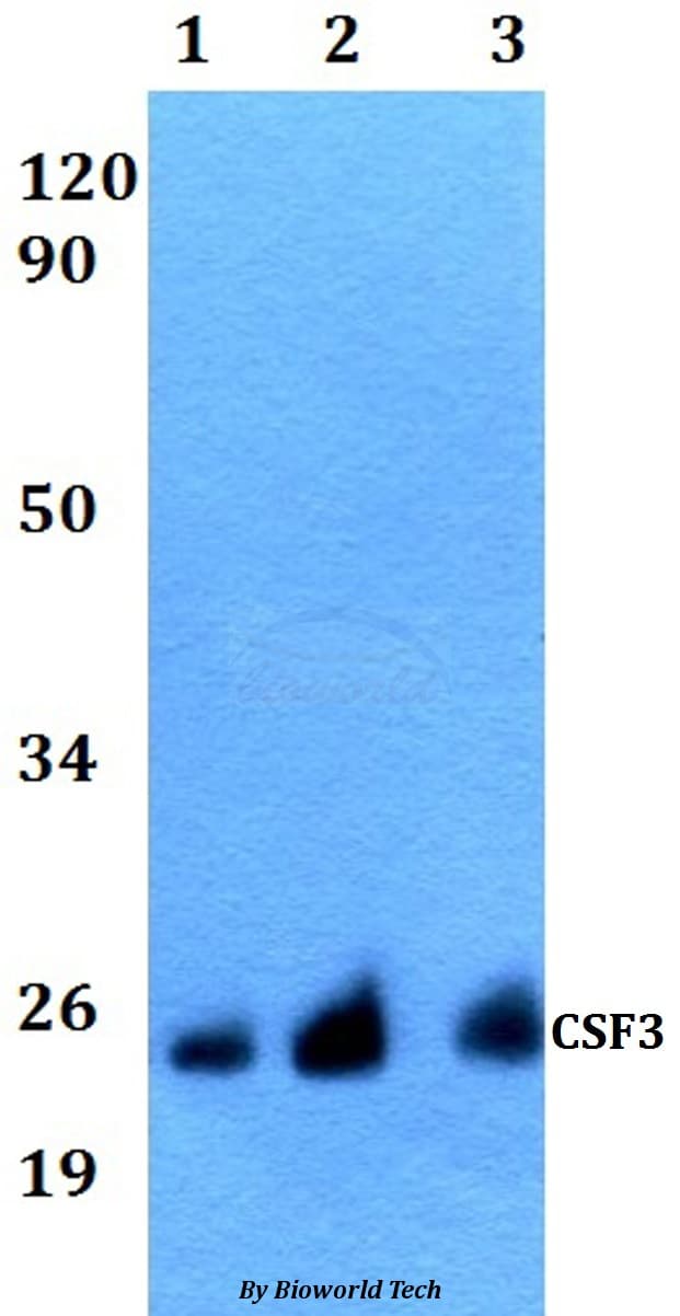 CSF3 / G-CSF Antibody