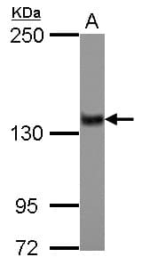 Polyclonal Rabbit anti-Human ZNF217 Antibody (Internal, IHC, WB)