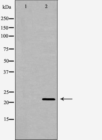 LTA / TNF Beta Antibody