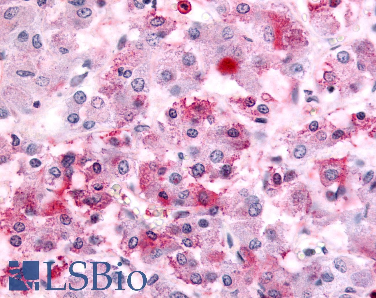 IHC-plus™ Polyclonal Rabbit anti-Human GPR152 Antibody (C-Terminus, IHC)