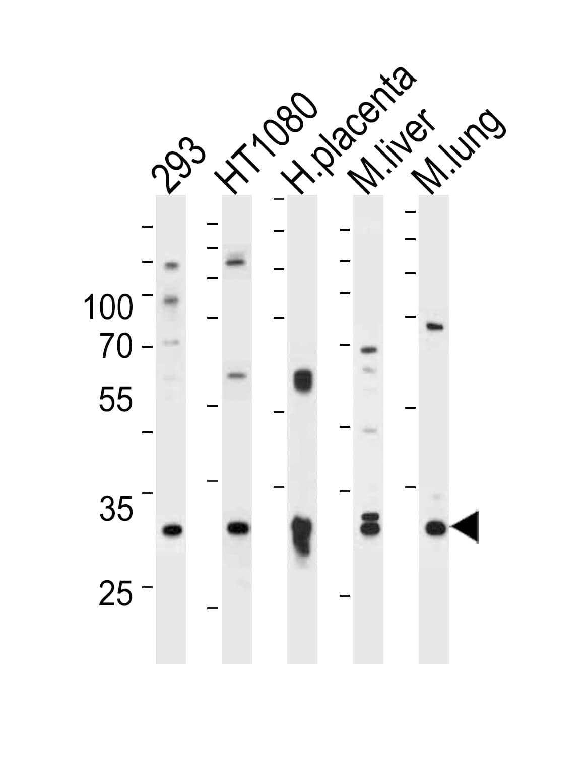 IHC-plus™ SAR1A / SAR1 Antibody (aa122-149)