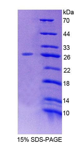 Rat ACOX2 Protein (Recombinant His-T7, N-terminus)