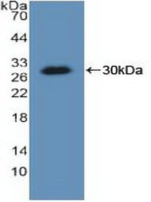Polyclonal Rabbit anti-Human KARS Antibody (APC, aa323-553, WB)