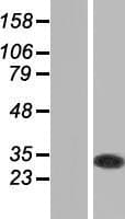 GSTO1 Protein (Over-Expression Lysate Myc-DDK (Flag))