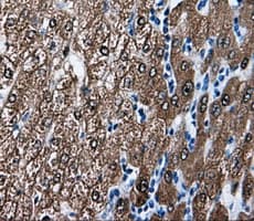 BHMT Antibody (clone OTI1E5)