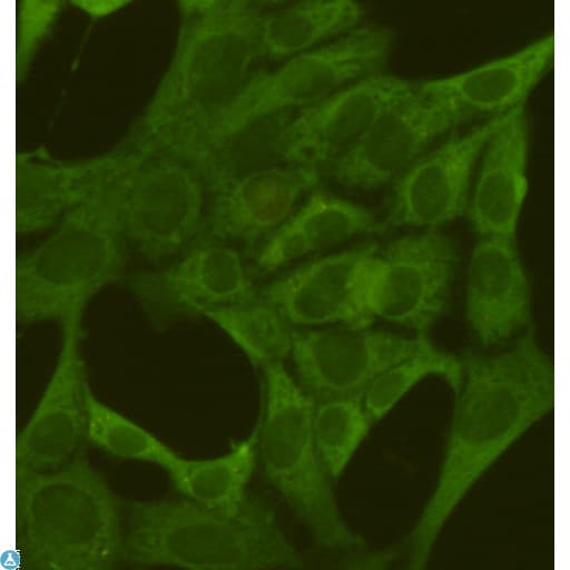 PKM / Pyruvate Kinase, Muscle Antibody