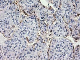 MAPRE2 / EB2 Antibody (clone OTI7A2)