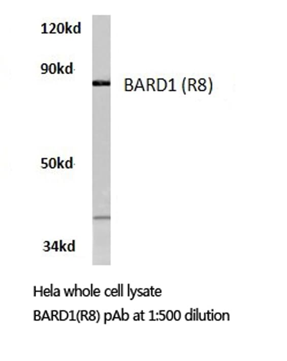 Polyclonal Rabbit anti-Human BARD1 Antibody (Arg8, IHC, WB)
