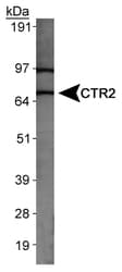 SLC31A2 Antibody (Internal)