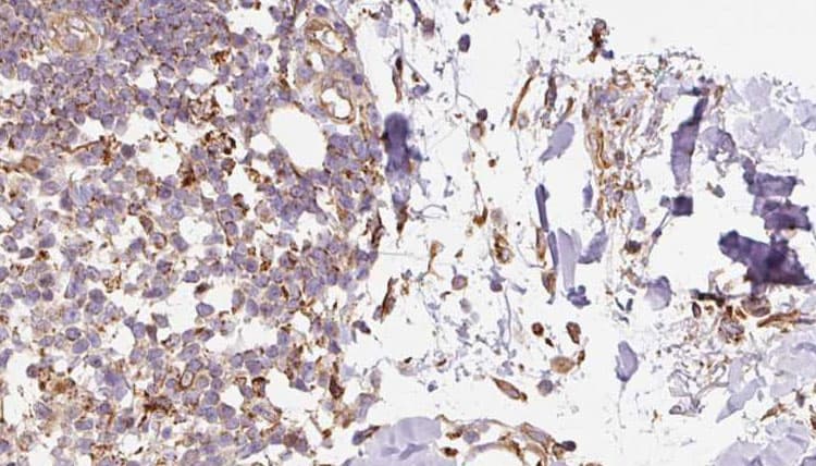 GHRL / Ghrelin Preproprotein Antibody
