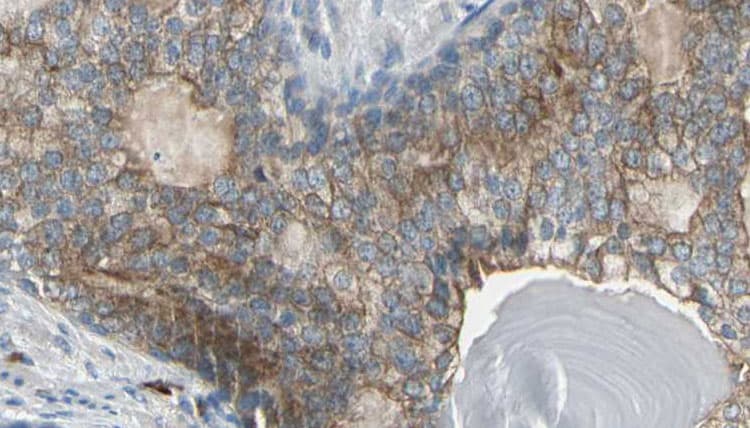 CKM / Creatine Kinase MM Antibody