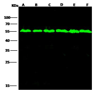 TUBB / Beta Tubulin Antibody (clone 05, Preservative Free)