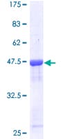 Human Recoverin Protein (Recombinant GST)