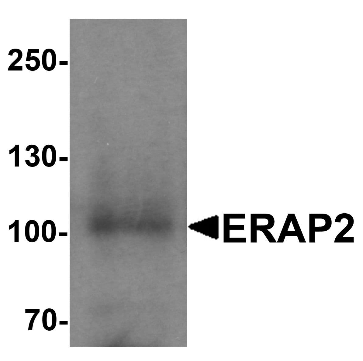 IHC-plus™ ERAP2 / Aminopeptidase Antibody
