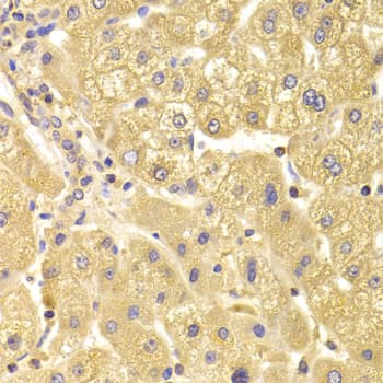 Polyclonal Rabbit anti-Human TRAF3IP2 / ACT1 Antibody (IHC, WB)