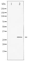 HSPB1 / HSP27 Antibody