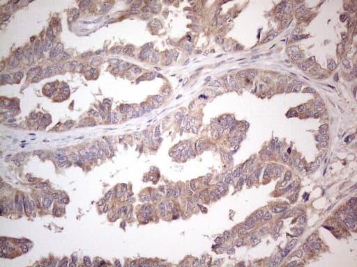 AMTN Antibody (clone OTI1D6)