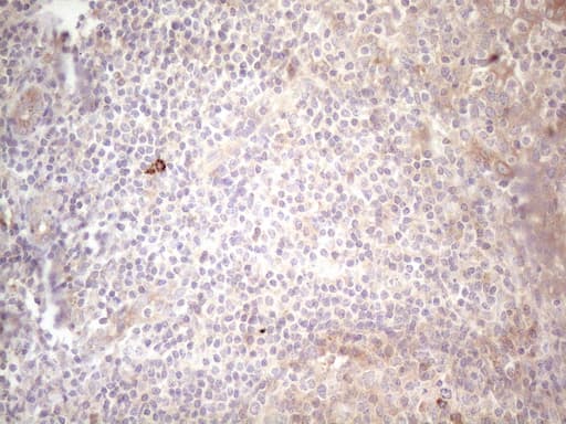 c-Kit / CD117 Antibody (aa27-308, clone OTI1B6)
