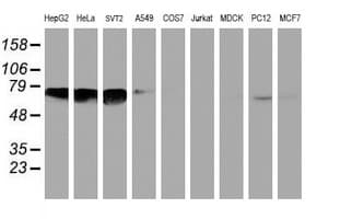 NMT2 Antibody (clone OTI2A5)