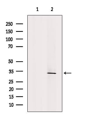 CLTB Antibody