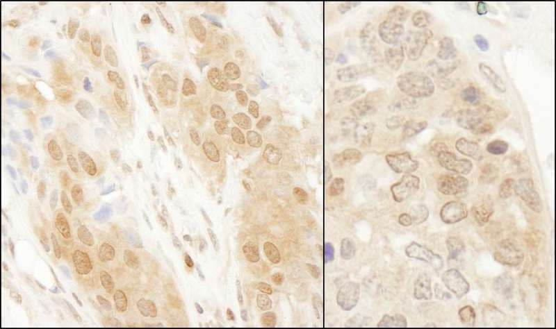 PARK7 / DJ-1 Antibody (aa140-C-term)