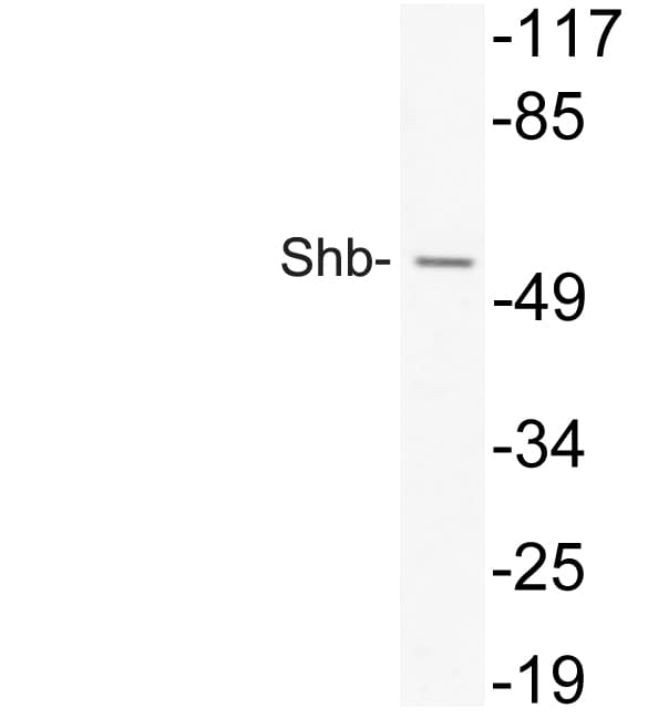 Polyclonal Rabbit anti-Human SHB Antibody (aa191-240, WB)